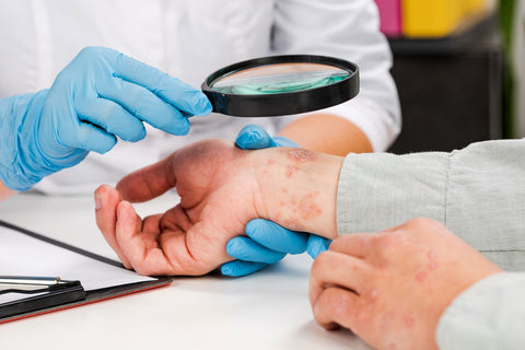 The Ketogenic Revolution Your Dermatologist Won't Tell You About